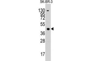 Western Blotting (WB) image for anti-Acetyl-CoA Acetyltransferase 1 (ACAT1) antibody (ABIN3003291) (ACAT1 anticorps)