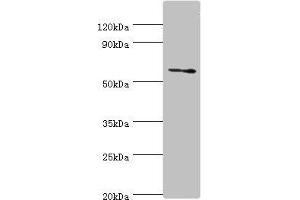 Western blot All lanes: DHCR24 antibody at 2 μg/mL + Jurkat whole cell lysate Secondary Goat polyclonal to rabbit IgG at 1/10000 dilution Predicted band size: 61, 55 kDa Observed band size: 61 kDa (Seladin 1 anticorps  (AA 227-516))