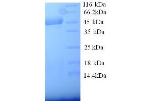 SDS-PAGE (SDS) image for Selectin E (SELE) (AA 23-429), (Extracellular) protein (His tag) (ABIN5713816)