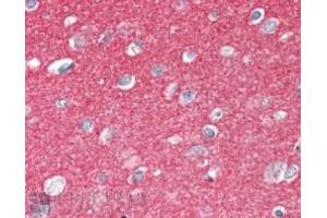 ABIN185392 (2. (SNAP25 anticorps  (C-Term))