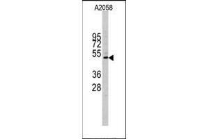 Image no. 1 for anti-Cyclin E1 (CCNE1) (C-Term) antibody (ABIN358767) (Cyclin E1 anticorps  (C-Term))