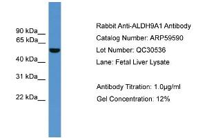 WB Suggested Anti-ALDH9A1  Antibody Titration: 0. (ALDH9A1 anticorps  (C-Term))