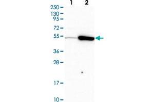 Western blot analysis of Lane 1: Human cell line RT-4 Lane 2: Human cell line U-251MG sp with TRIP6 polyclonal antibody  at 1:500-1:1000 dilution. (TRIP6 anticorps)
