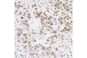 Immunohistochemistry (IHC) image for anti-Fused in Sarcoma (FUS) (AA 1-50) antibody (ABIN7454607)