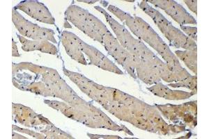 IHC testing of FFPE mouse heart tissue with Dnmt1 antibody at 1ug/ml. (DNMT1 anticorps)