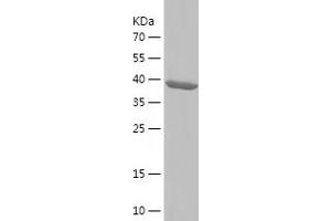 Western Blotting (WB) image for EH-Domain Containing 4 (EHD4) (AA 1-171) protein (His-IF2DI Tag) (ABIN7122751)