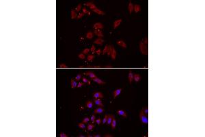 Immunofluorescence analysis of U2OS cell using NPHP1 antibody. (NPHP1 anticorps)