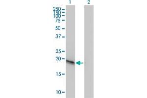 Western Blot analysis of C20orf102 expression in transfected 293T cell line by C20orf102 monoclonal antibody (M01), clone 3B9. (VSTM2L anticorps  (AA 25-204))