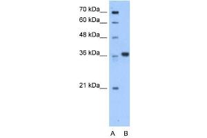 AASDHPPT antibody used at 0.