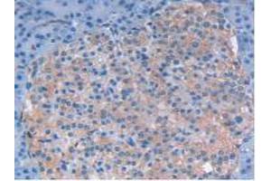 IHC-P analysis of Human Pancreas Tissue, with DAB staining. (LIF anticorps  (AA 2-201))