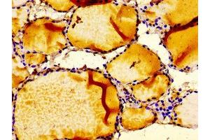 Immunohistochemistry of paraffin-embedded human thyroid tissue using ABIN7156373 at dilution of 1:100 (IGFBP6 anticorps  (AA 32-161))
