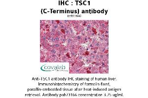 Image no. 1 for anti-Tuberous Sclerosis 1 (TSC1) (C-Term) antibody (ABIN1740408)