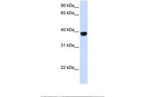 Image no. 1 for anti-Forkhead Box E1 (Thyroid Transcription Factor 2) (FOXE1) (AA 254-303) antibody (ABIN6737656) (FOXE1 anticorps  (AA 254-303))