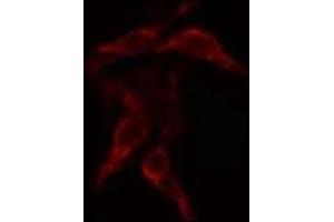 ABIN6268812 staining Hela cells by IF/ICC. (COL4a2 anticorps  (N-Term))