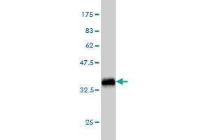 Western Blot detection against Immunogen (36. (TEK anticorps  (AA 701-800))