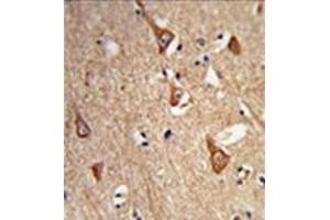Formalin-fixed,  paraffin-embedded human brain tissue reacted with Complexin-1 Antibody (Center) followed which was peroxidase-conjugated to the secondary antibody, followed by DAB staining.