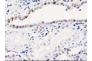 Immunohistochemistry (IHC) image for anti-Integral Membrane Protein 2B (ITM2B) antibody (ABIN1496395) (ITM2B anticorps)