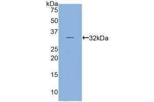 Detection of Recombinant MYH16, Human using Polyclonal Antibody to Myosin Heavy Chain 16 (MYH16) (MYH16 anticorps  (AA 209-469))
