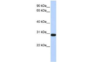 WB Suggested Anti-BPGM Antibody Titration: 0. (BPGM anticorps  (Middle Region))