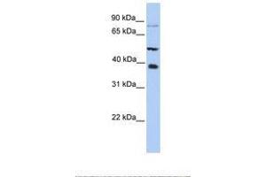 Image no. 1 for anti-Methyltransferase Like 2B (METTL2B) (N-Term) antibody (ABIN6738511) (METTL2B anticorps  (N-Term))