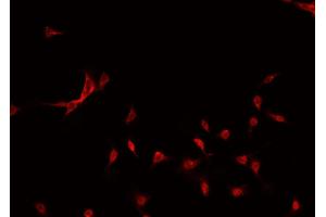 ABIN6269195 staining MCF-7 cells by IF/ICC. (GATA3 anticorps)