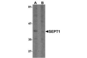 Western blot analysis of SEPT1 in Raji cell lysate with SEPT1 Antibody  at 1 µg/ml in (A) the absence and (B) the presence of blocking peptide. (Septin 1 anticorps  (C-Term))