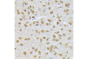 Immunohistochemistry of paraffin-embedded mouse brain using RPS27A antibody (ABIN3022728, ABIN3022729, ABIN1513489, ABIN1514633 and ABIN6219198) at dilution of 1:100 (40x lens). (RPS27A anticorps  (AA 1-156))