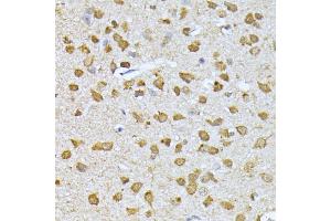 Immunohistochemistry of paraffin-embedded mouse brain using RPS27A antibody (ABIN3022728, ABIN3022729, ABIN1513489, ABIN1514633 and ABIN6219198) at dilution of 1:100 (40x lens). (RPS27A anticorps  (AA 1-156))