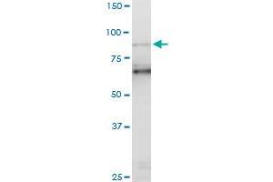 PCAF monoclonal antibody (M06), clone 5E5.
