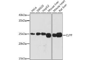 Western blot analysis of extracts of various cell lines, using CLPP Rabbit mAb (ABIN1682296, ABIN3017596, ABIN3017597 and ABIN7101508) at 1:1000 dilution.