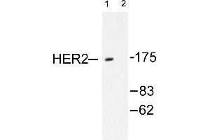 Image no. 1 for anti-Receptor tyrosine-protein kinase erbB-2 (ErbB2/Her2) antibody (ABIN265464) (ErbB2/Her2 anticorps)