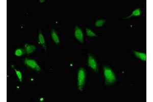 Immunofluorescent analysis of Hela cells using ABIN7152417 at dilution of 1:100 and Alexa Fluor 488-congugated AffiniPure Goat Anti-Rabbit IgG(H+L) (FBXO25 anticorps  (AA 1-291))