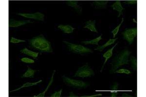 Immunofluorescence of monoclonal antibody to SFN on HeLa cell. (14-3-3 sigma/SFN anticorps  (AA 1-248))