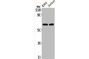 Western Blot analysis of K562 Jurkat cells using CLCC1 Polyclonal Antibody (CLCC1 anticorps  (Internal Region))
