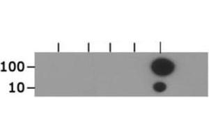 Dot Blot of Rabbit Histone H3 [ac Lys18] Antibody.