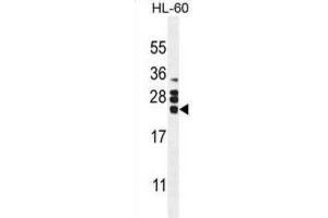 Western Blotting (WB) image for anti-Colony Stimulating Factor 2 (Granulocyte-Macrophage) (CSF2) antibody (ABIN2995782) (GM-CSF anticorps)