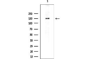 Western blot analysis of lysates from EC304 cells(heat-shock treatment), using PER3 Antibody at 1/1000 dilution.