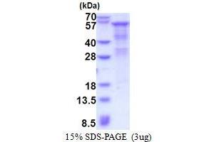 Heparanase (HPSE) (AA 36-543) protein (His tag)