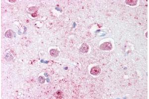 Human Brain, Cortex (formalin-fixed, paraffin-embedded) stained with LINGO1 antibody ABIN239799 at 20 ug/ml followed by biotinylated goat anti-rabbit IgG secondary antibody ABIN481713, alkaline phosphatase-streptavidin and chromogen. (LINGO1 anticorps  (C-Term))