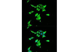 Immunofluorescence analysis of A549 cells using CD55 antibody.