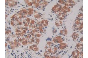 DAB staining on IHC-P; Samples: Human Stomach Tissue