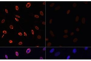 Immunofluorescence analysis of NIH/3T3 cells using Acetyl-Histone H3-K36 Polyclonal Antibody at dilution of 1:100. (Histone 3 anticorps  (acLys36))