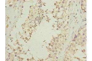 Immunohistochemistry of paraffin-embedded human testis tissue using ABIN7145131 at dilution of 1:100 (DNALI1 anticorps  (AA 1-258))