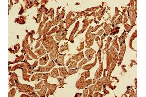 Immunohistochemistry of paraffin-embedded human heart tissue using ABIN7146522 at dilution of 1:100