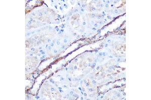Immunohistochemistry of paraffin-embedded rat kidney using T Rabbit pAb (ABIN6130537, ABIN6143503, ABIN6143504 and ABIN6215581) at dilution of 1:100 (40x lens).