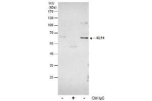 IP Image Immunoprecipitation of KLF4 protein from HeLa whole cell extracts using 5 μg of KLF4 antibody, Western blot analysis was performed using KLF4 antibody, EasyBlot anti-Rabbit IgG  was used as a secondary reagent. (KLF4 anticorps  (C-Term))