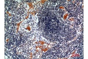 Immunohistochemistry (IHC) analysis of paraffin-embedded Human Lymph, it was diluted at 1:100. (CSF2RA anticorps  (Internal Region))