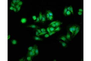 Immunofluorescence staining of HepG2 cells with ABIN7146984 at 1:166, counter-stained with DAPI.