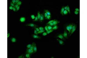 Immunofluorescence staining of HepG2 cells with ABIN7146984 at 1:166, counter-stained with DAPI. (CTNNB1 anticorps  (AA 2-781))