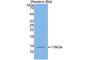 Western Blotting (WB) image for anti-Complement Component C4b (C4b) (AA 680-756) antibody (ABIN1866970) (C4B anticorps  (AA 680-756))
